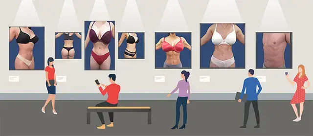BREAST AUGMENTATION — before and after results