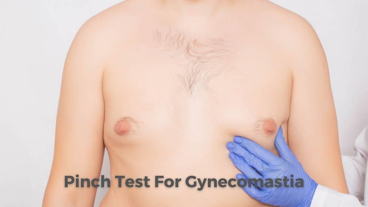 Gynecomastia pinch test