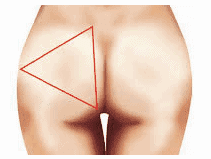 Butt Enhancemen