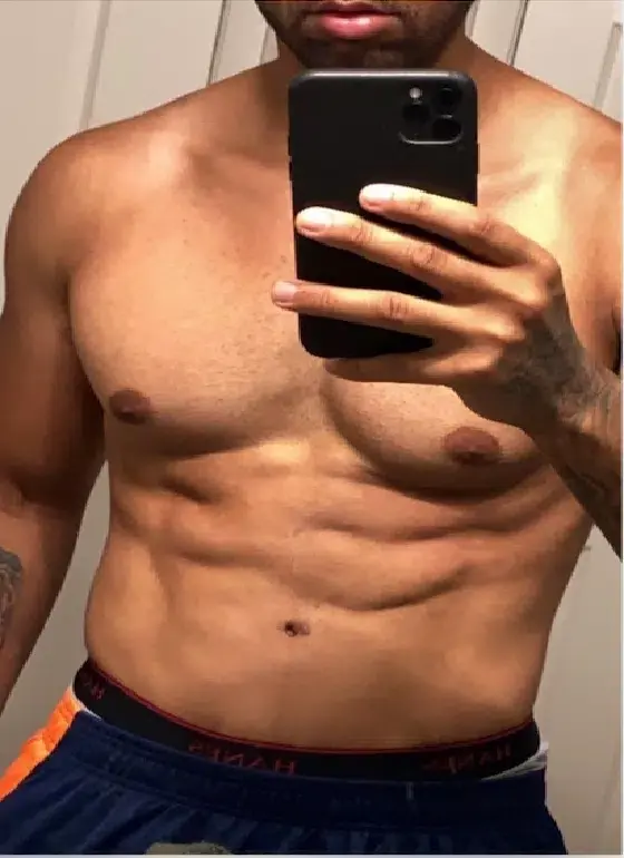 Actual male patient selfie after high-definition contouring.