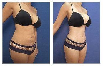 Waistline 11