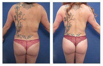 How to Get a Jennifer Lopez Butt How to Get a Jennifer Lopez Butt