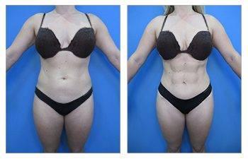 Woman in swimwear posing for a front-facing photo against a blue backdrop. Woman in swimwear posing for a front-facing photo against a blue backdrop.