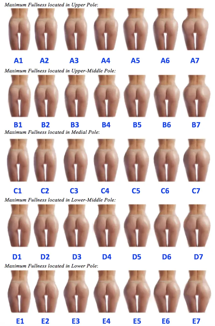 Brazilian Butt Lift Calculator LA Brazilian Butt Lift Calculator LA