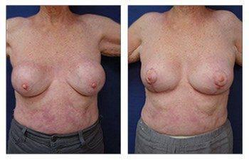 Cosmetic Surgery Los Angeles Cosmetic Surgery Los Angeles