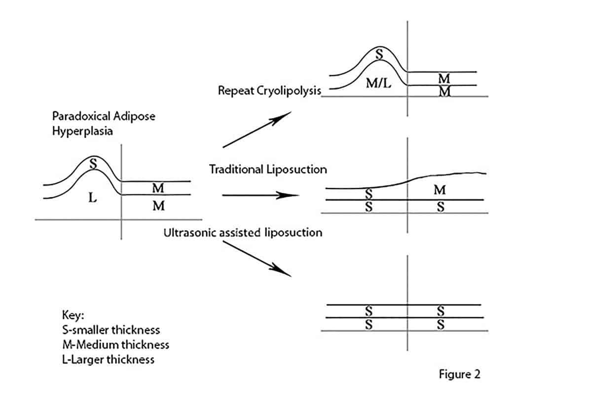 Figure 2 Figure 2