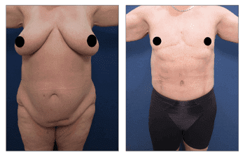 Transgender Female to male Transgender Female to male