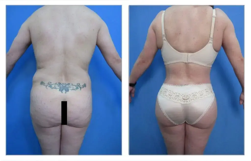 A woman's back and side view of a woman's body.
