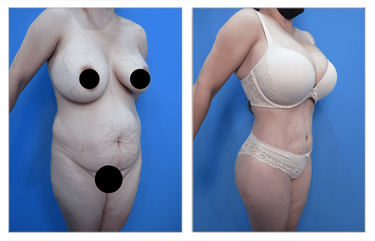 Avoid Skin Redundancy Avoid Skin Redundancy