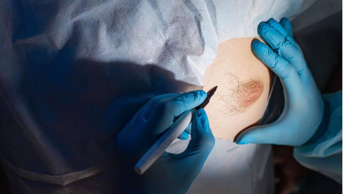 is-gynecomastia-painful? is-gynecomastia-painful?