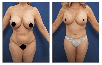 A collage of images showing different types of entertainment, including a billboard for liposuction in San Pedro. A collage of images showing different types of entertainment, including a billboard for liposuction in San Pedro.