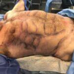 Male Plastic Surgery Male Plastic Surgery
