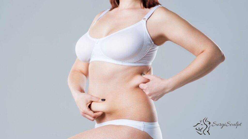 Reverse Tummy Tuck