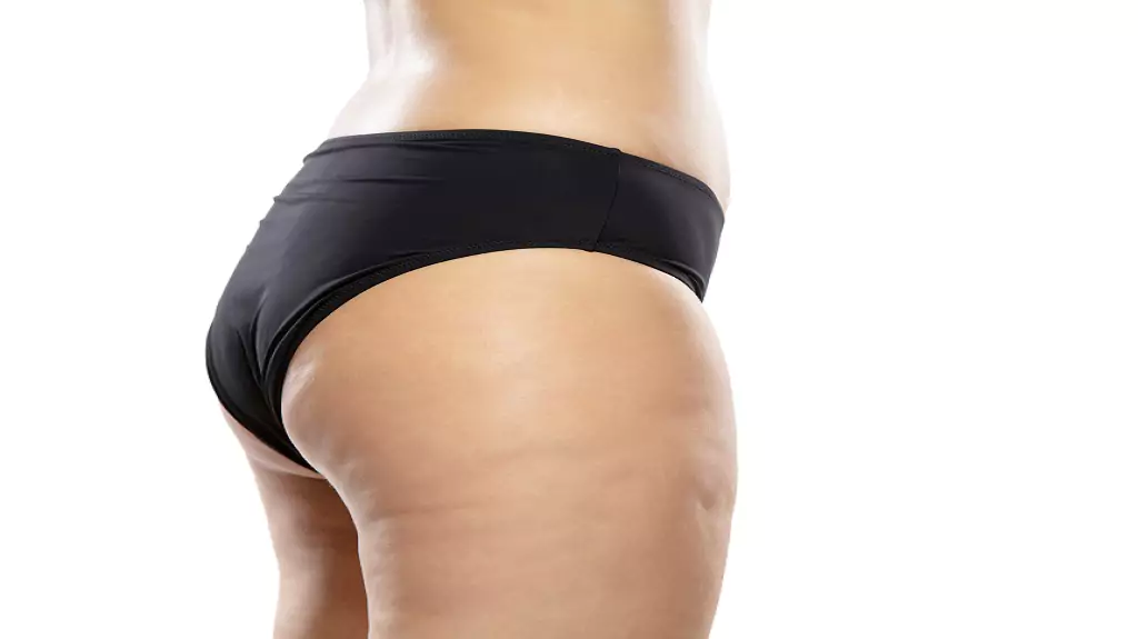 Get Rid of Banana Roll Fat, Banana Roll Fat Treatments