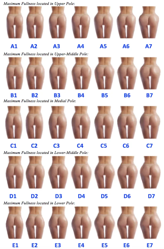 Brazilian Butt Lift Calculator LA