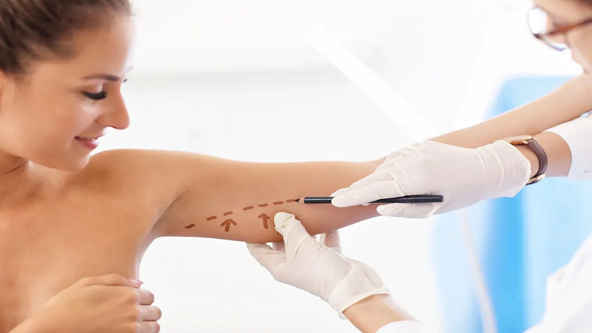 Attiva NonSurgical Arm Lift